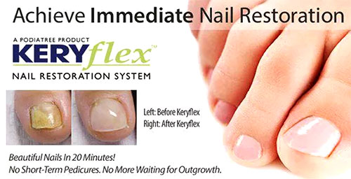 Keryflex Nail Restoration in the Broward County, FL: Fort Lauderdale (Sunrise, Oakland Park, Dania Beach, Lauderhill, Coconut Creek) areas